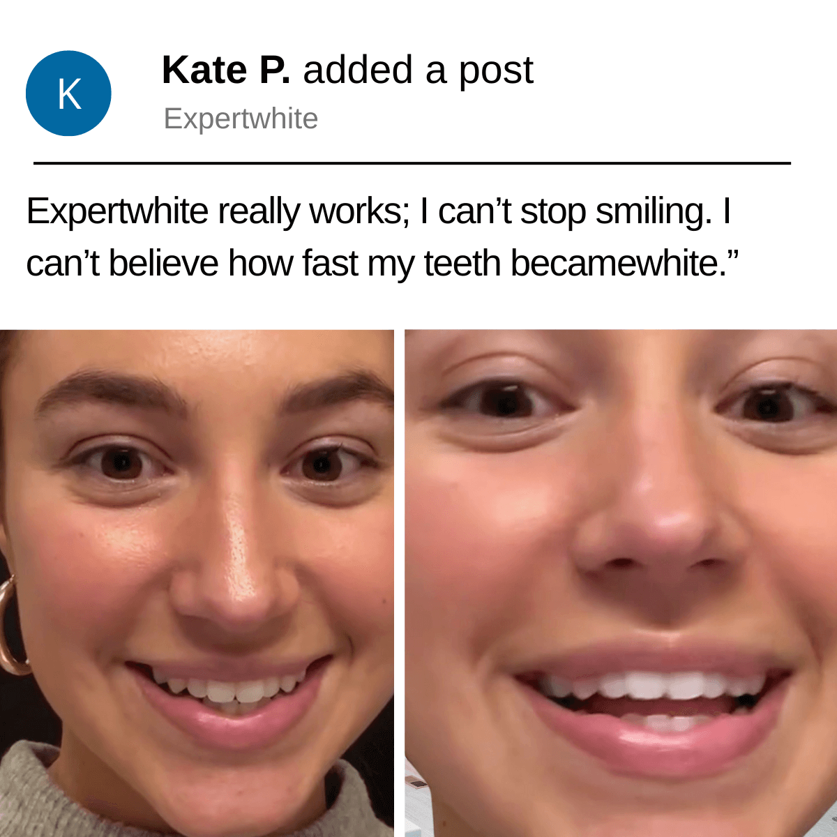 Expertwhite Teeth Whiteners Expertwhite 12HP Max Instant Whitening Strips (3-packs)