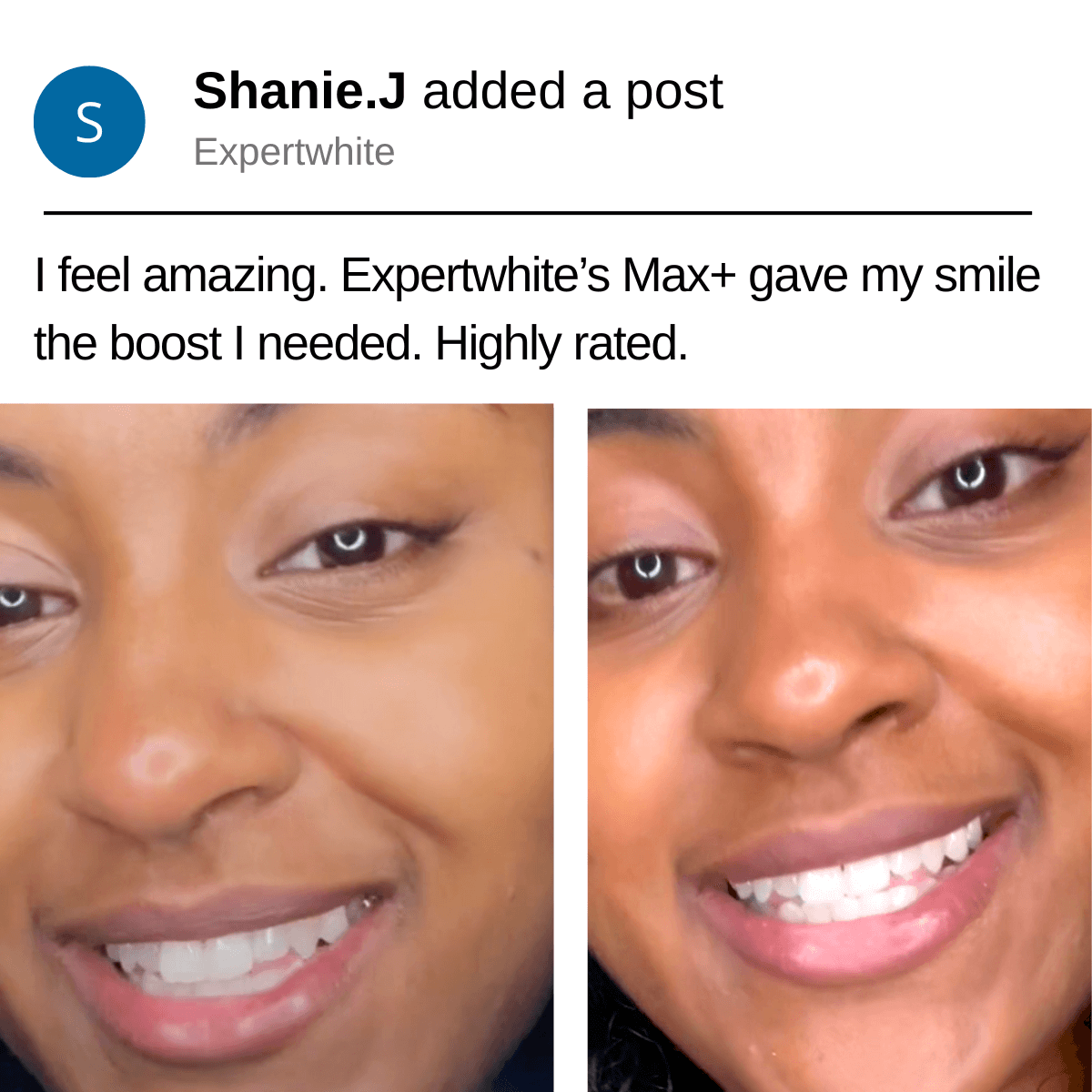 Expertwhite Teeth Whitening Kit Expertwhite 12HP Max Prefilled Whitening Trays (3-packs)