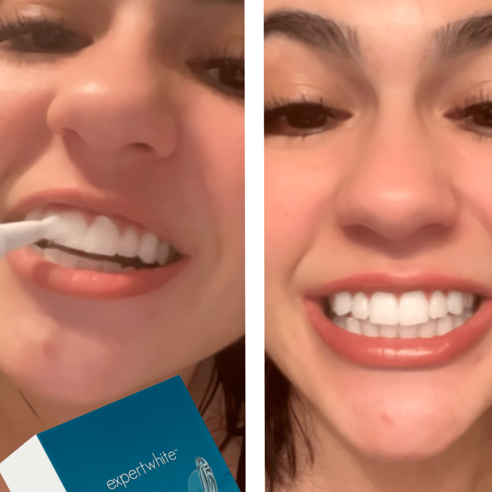 Expertwhite Teeth Whitening Kit LED Copy of Confidence! Teeth Whitening Kit (Brush-on Gels, LED Light)