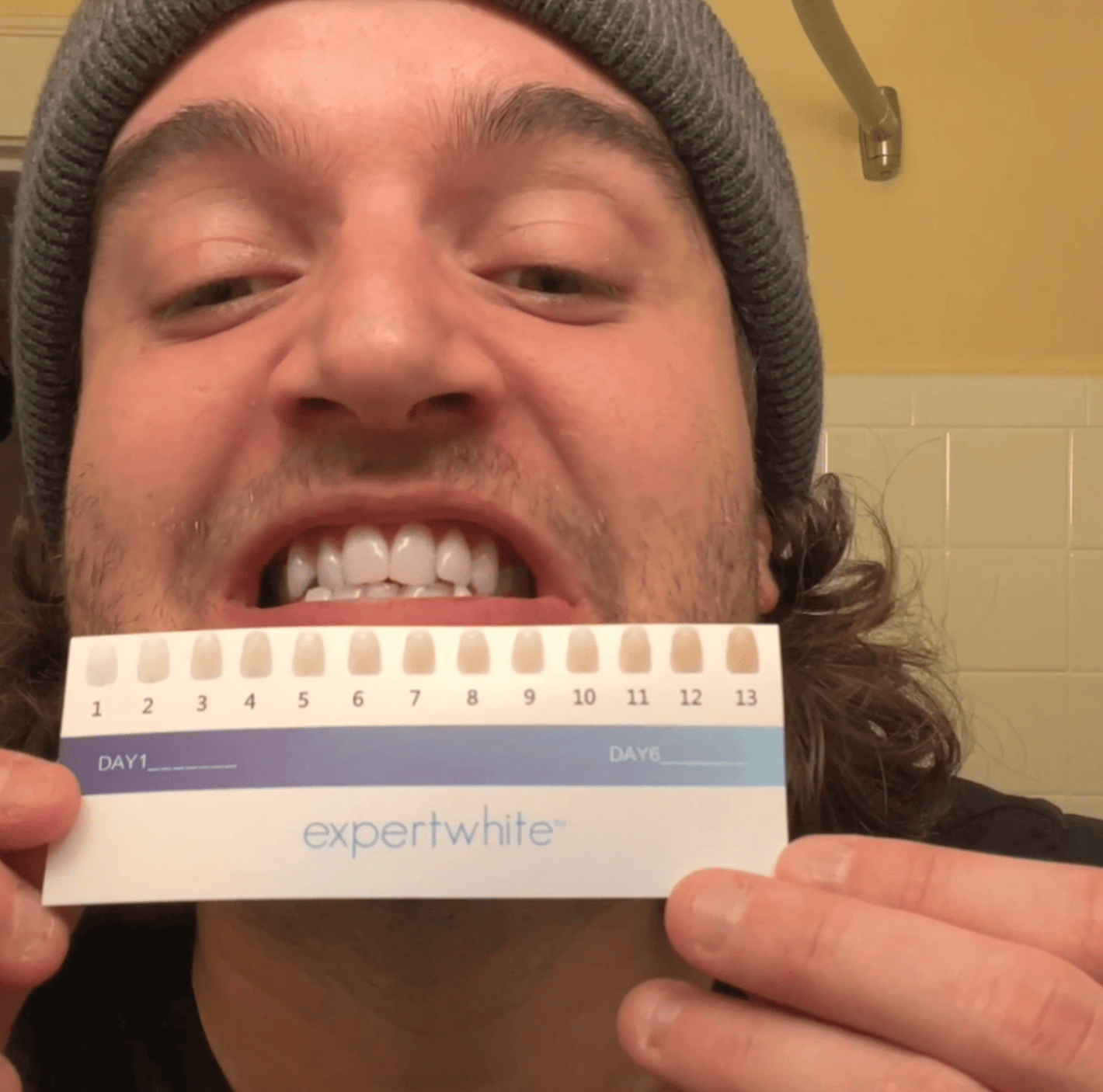 Expertwhite Teeth Whitening Kit LED One Kit Teeth Whitening LED BRUSH Kit