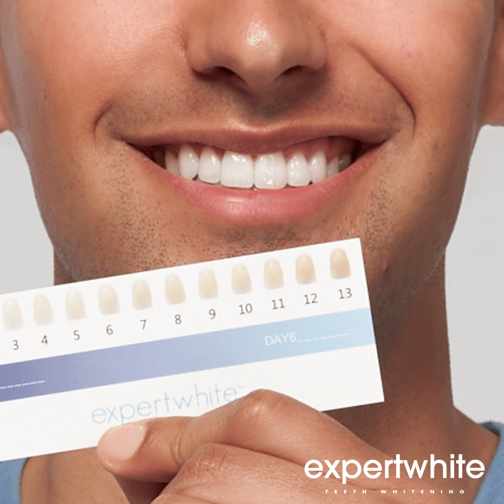 Expertwhite Teeth Whitening Kit QuickGlo LED Tray Kit
