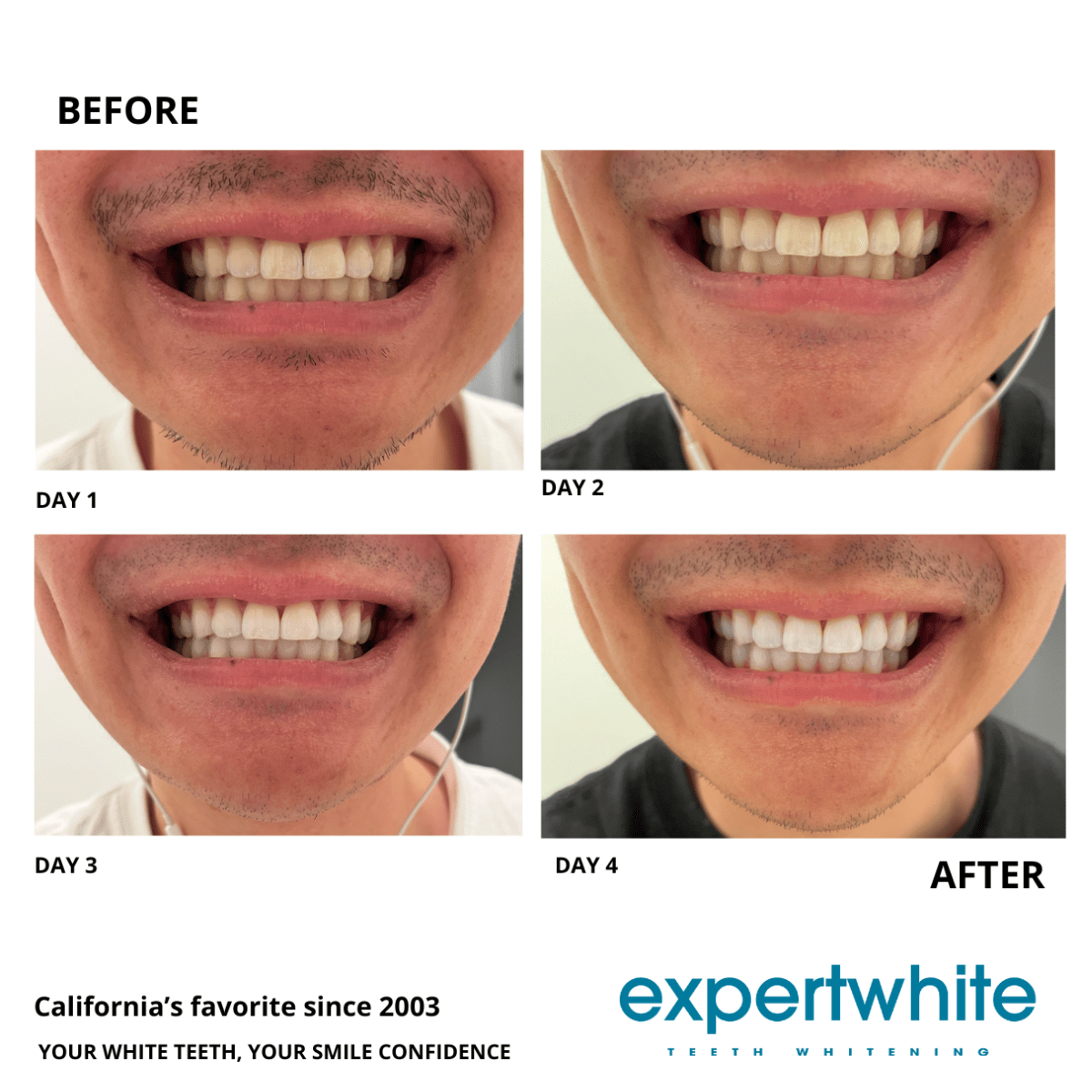 Expertwhite Teeth Whitening strips Expert White Strips - Instant Glow