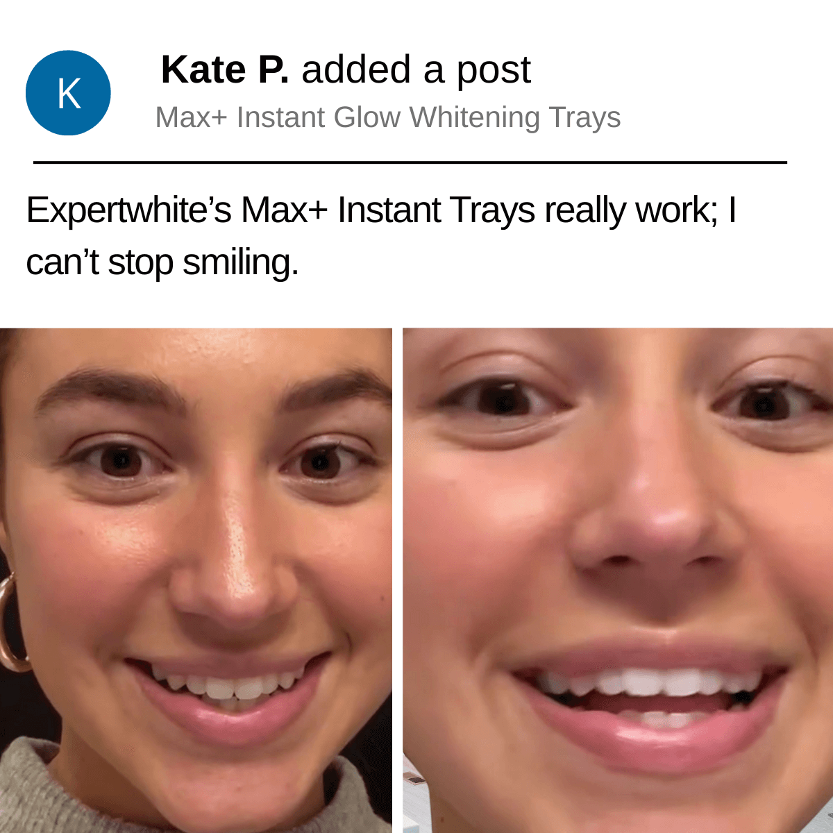 Expertwhite Teeth Whitening strips Expertwhite 12HP Instant Whitening Strips