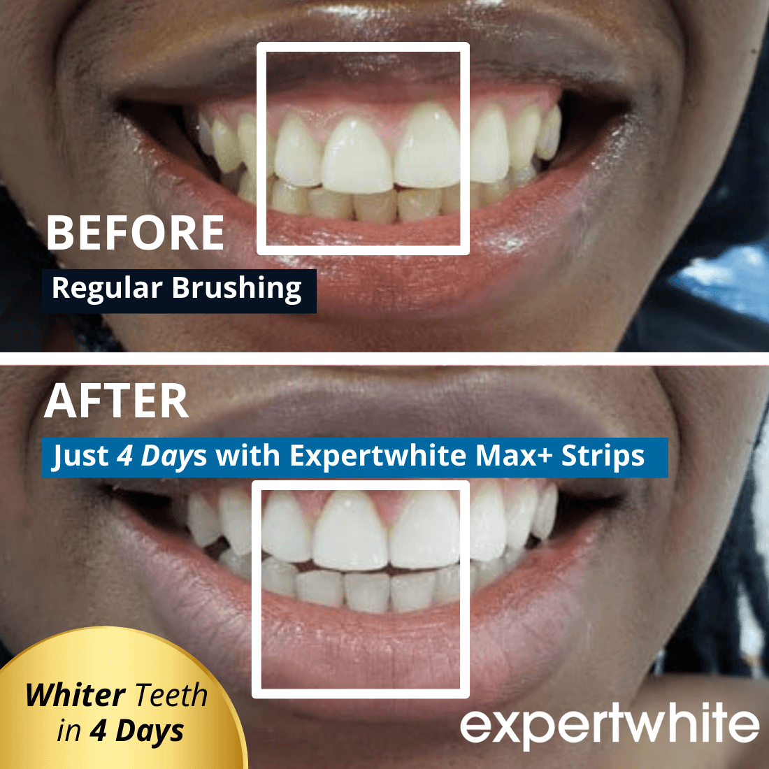 Expertwhite Teeth Whitening strips Expertwhite Max+ Instant Glow Whitening Strips