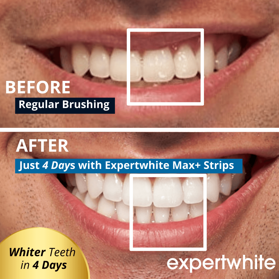 Expertwhite Teeth Whitening strips Expertwhite Max+ Instant Glow Whitening Strips