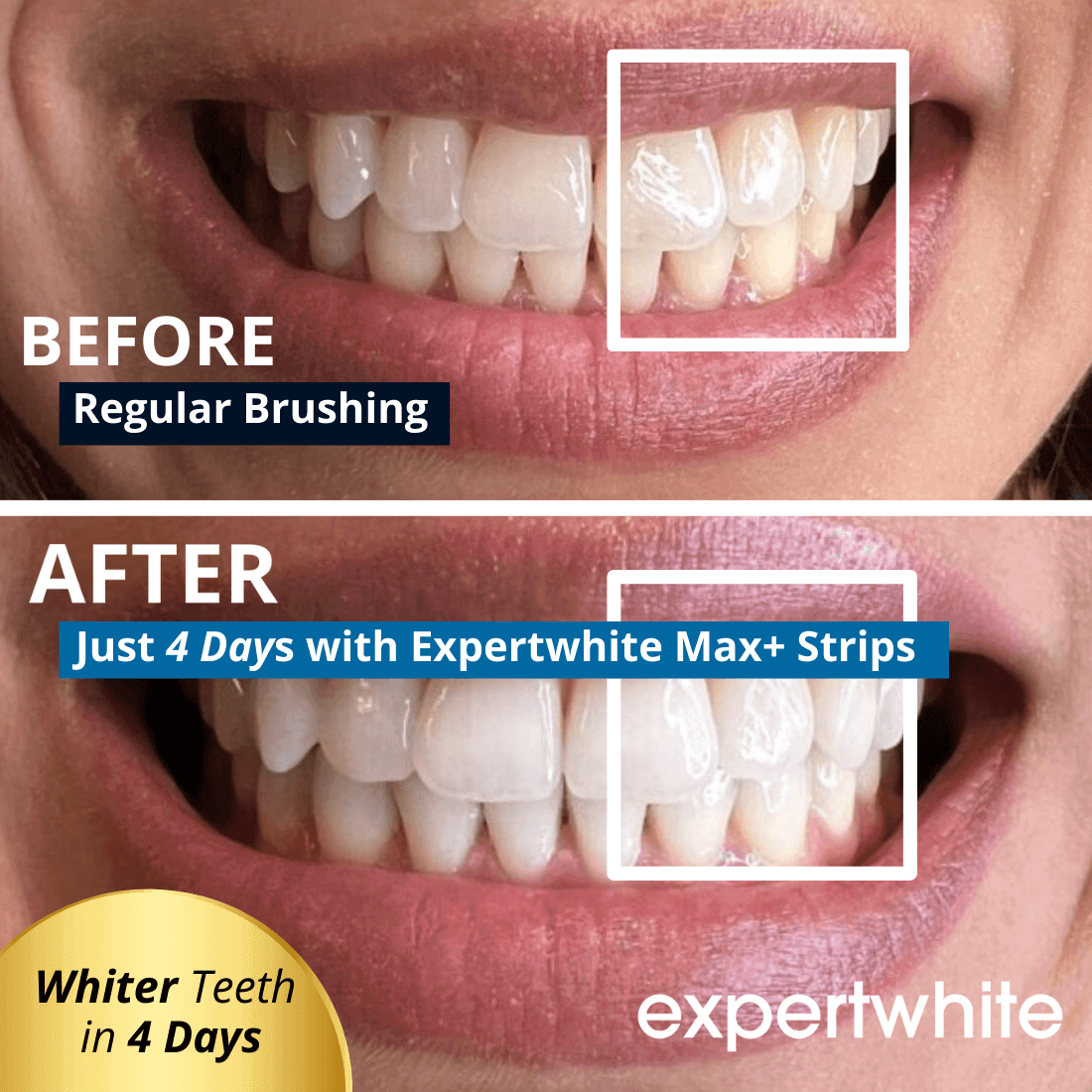 Expertwhite Teeth Whitening strips Expertwhite Max+ Instant Glow Whitening Strips