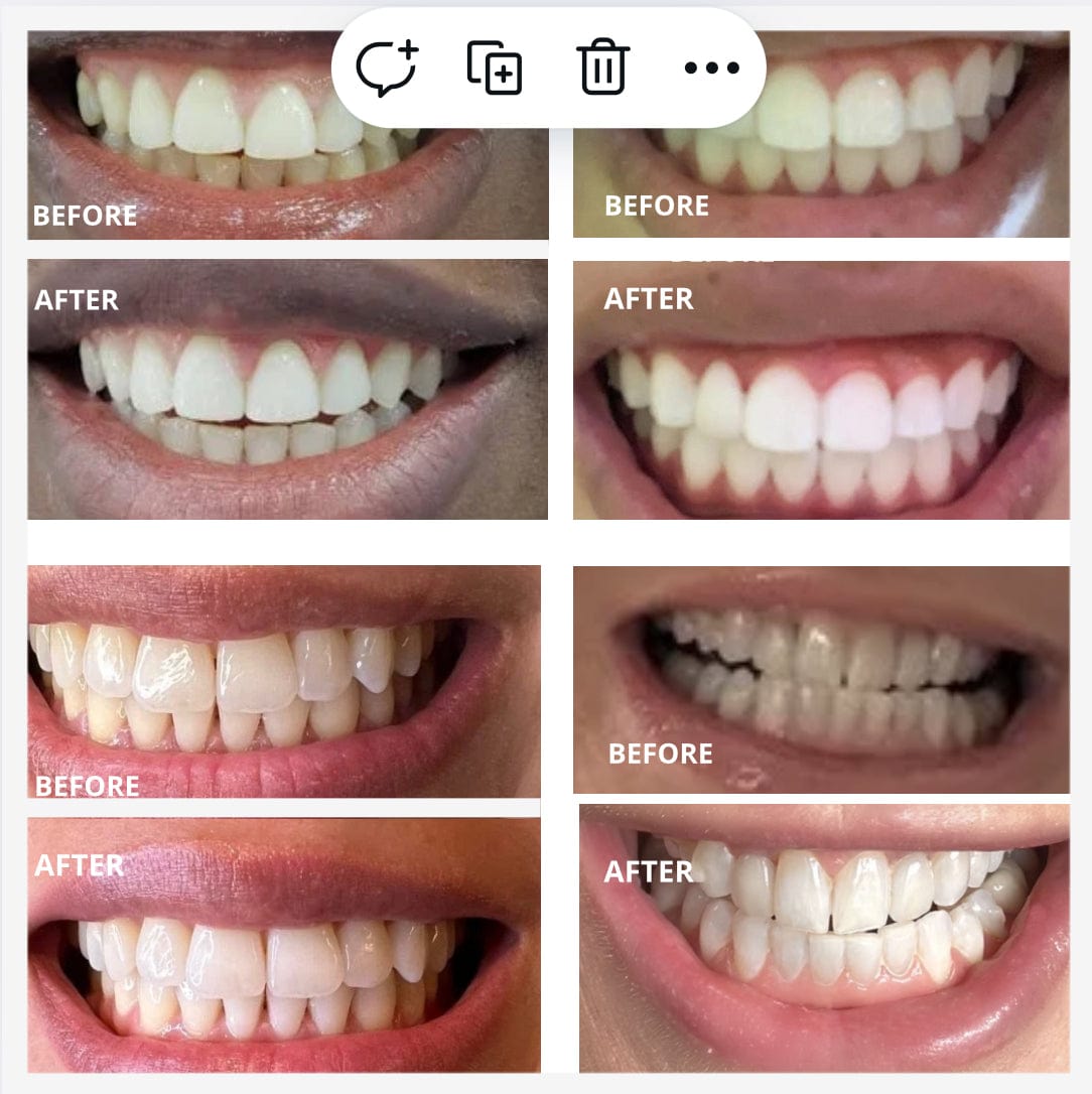 Expertwhite Teeth Whitening strips Max+ Instant Whitening Strips