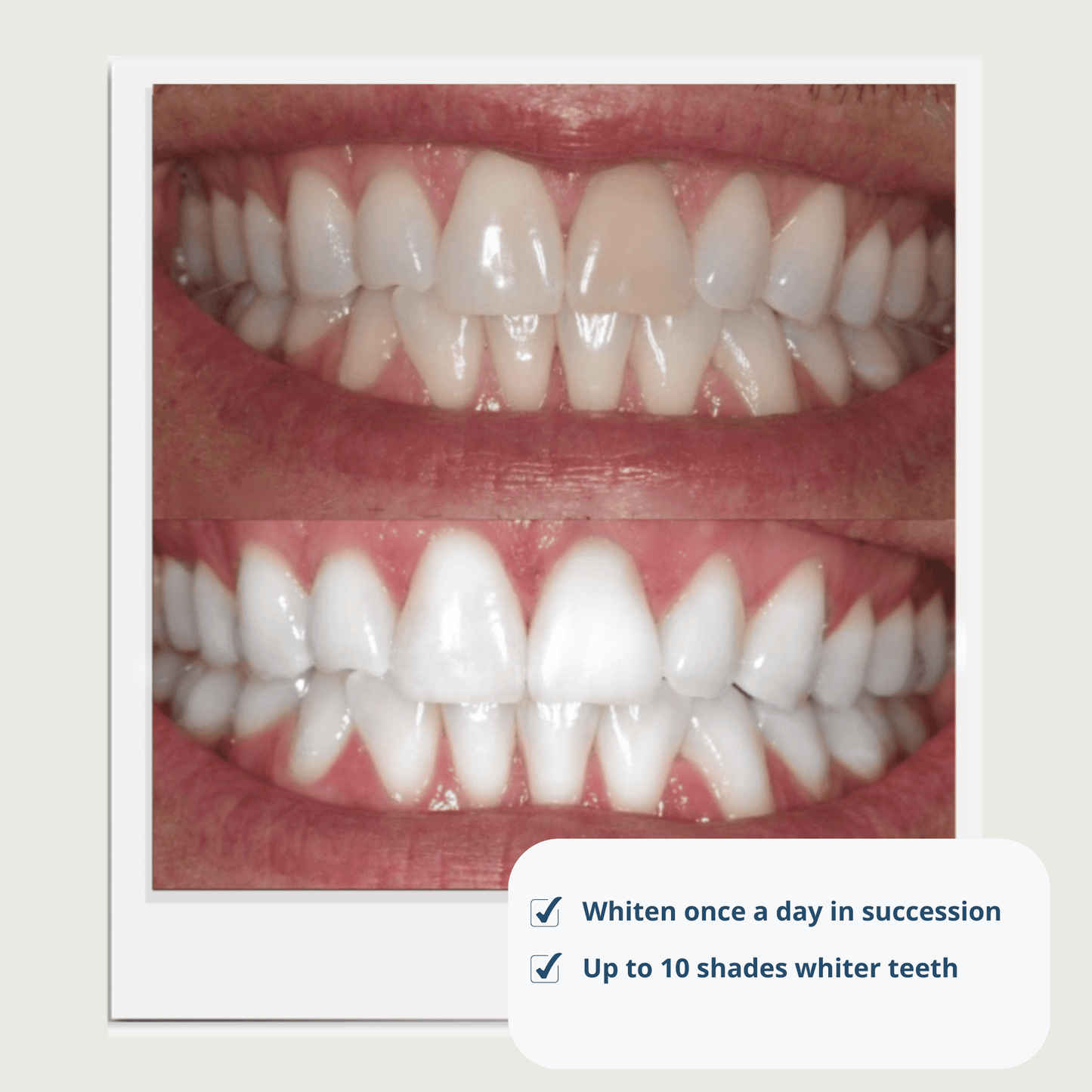 Expertwhite Aligner Retainer Cleaner Aligner & Retainer Cleaner –Peroxide Teeth Whitening Foam,  Daily Stain Control, and Brilliantly Clear Retainers.
