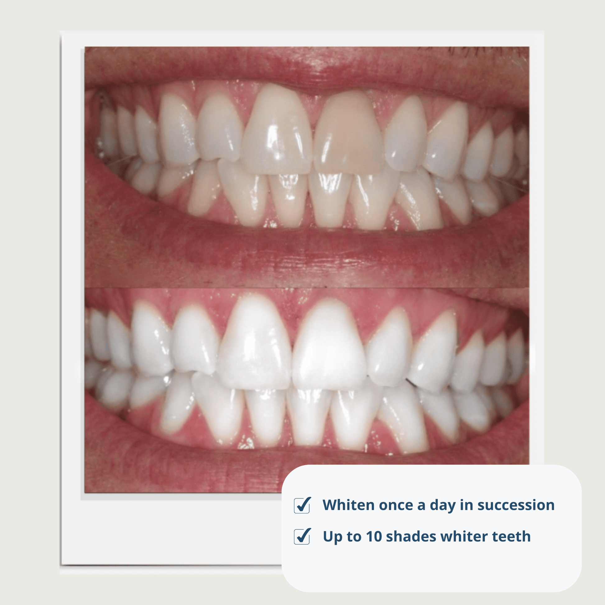 Expertwhite Aligner Retainer Cleaner Aligner & Retainer Cleaner –Peroxide Teeth Whitening Foam,  Daily Stain Control, and Brilliantly Clear Retainers.