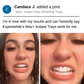 Expertwhite Aligner Retainer Cleaner Aligner & Retainer Cleaner –Peroxide Teeth Whitening Foam,  Daily Stain Control, and Brilliantly Clear Retainers.