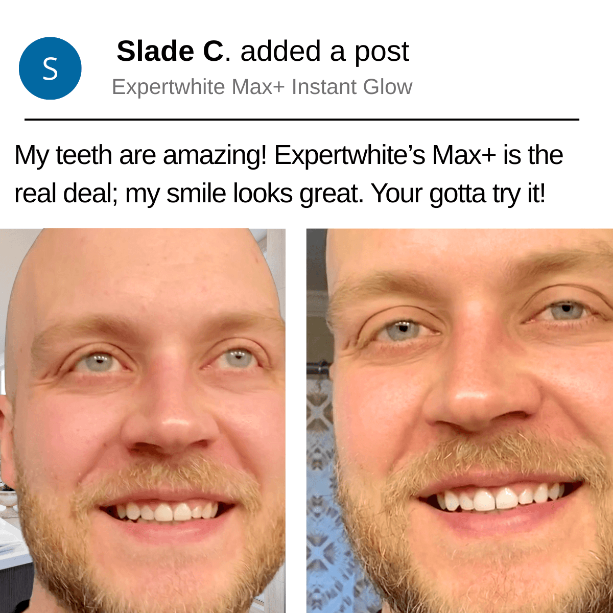 Expertwhite Expertwhite 12HP Max Prefilled Whitening Trays (5-packs)