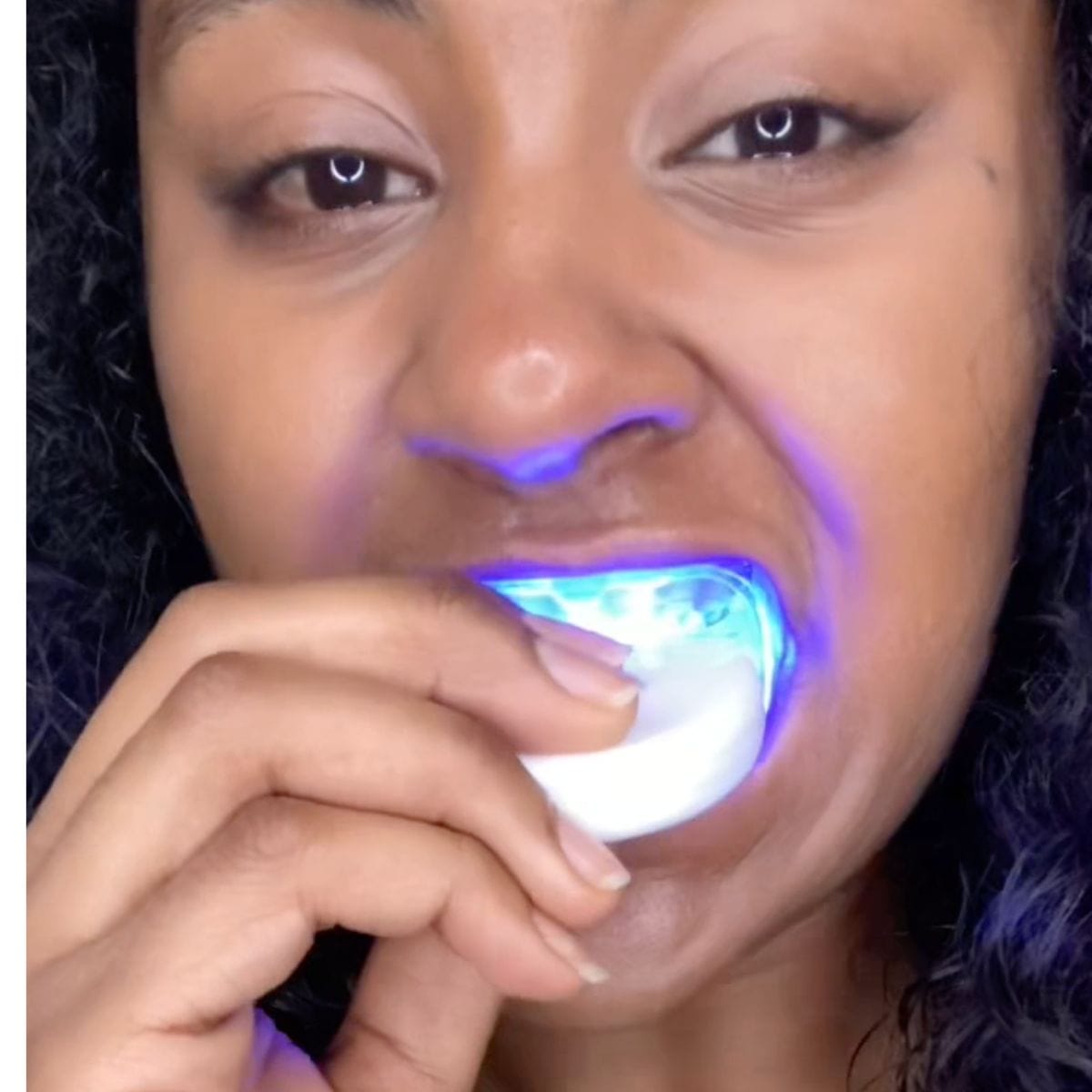 Expertwhite Expertwhite LED Teeth Whitening Light with Mouth Tray (upper and lower)