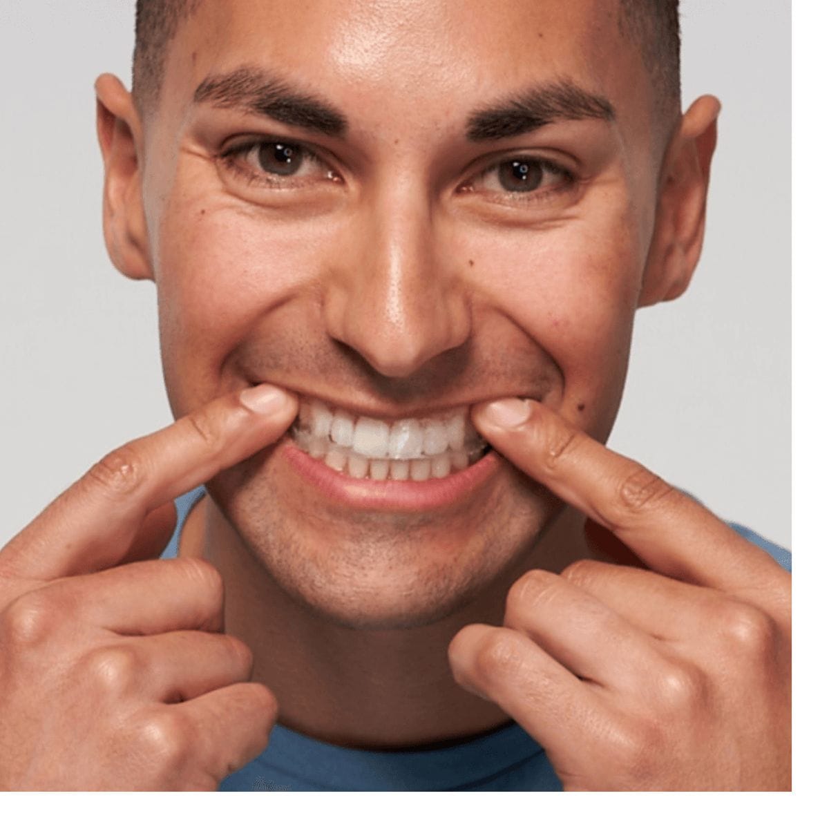 Expertwhite Prefilled Whitening Trays 12HP USA (5 Pack) | Expertwhite