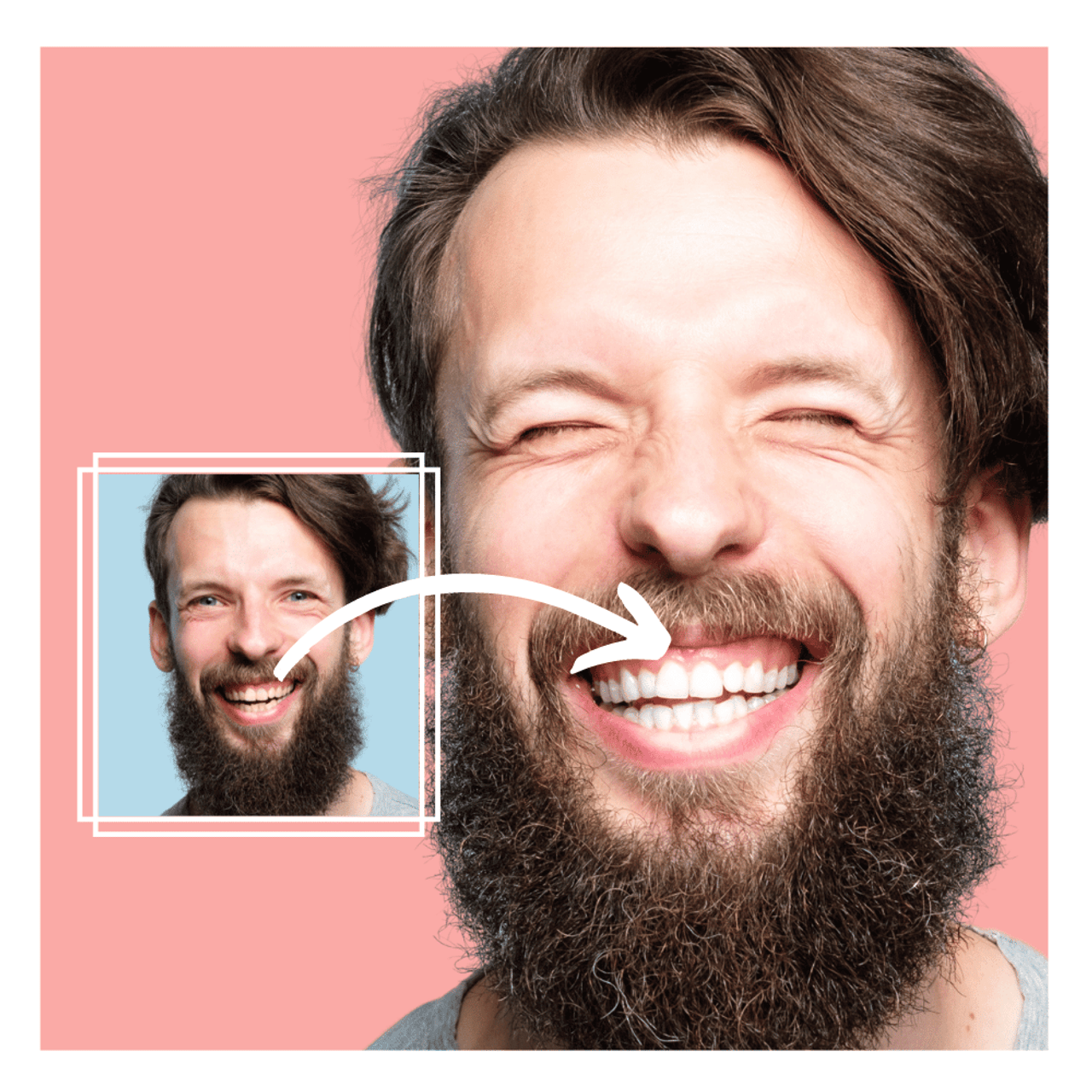 Expertwhite Teeth whitener gel Teeth Whitening Gel – Dentist-Grade Aligner & Tray Whitening | Expertwhite (Made in USA)