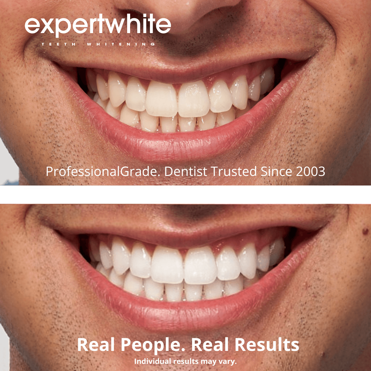 Expertwhite Teeth Whiteners Max+ Instant Glow Whitening Strips (3-pack) Save 25% Off