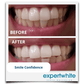 Expertwhite Teeth Whiteners Teeth Whitening Pen – Dentist Grade Peroxide Gel, Erases Stains on the Go - So Your Teeth Are Always White - Ready To Smile Your Best
