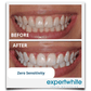 Expertwhite Teeth Whiteners Teeth Whitening Pen – Dentist Grade Peroxide Gel, Erases Stains on the Go - So Your Teeth Are Always White - Ready To Smile Your Best