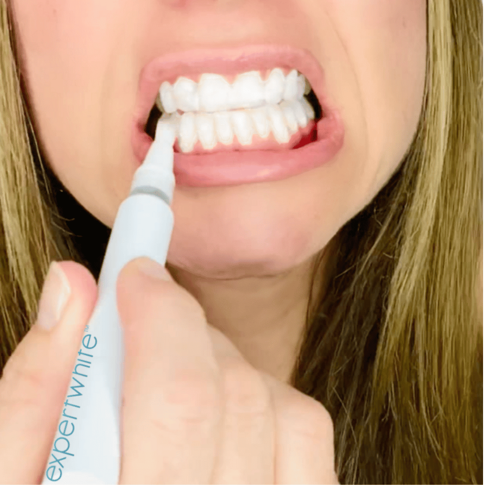 Expertwhite Teeth Whiteners Teeth Whitening Pen – Dentist Grade Peroxide Gel, Erases Stains on the Go - So Your Teeth Are Always White - Ready To Smile Your Best