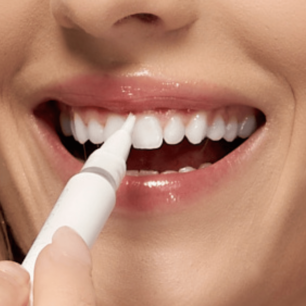 Expertwhite Teeth Whiteners Teeth Whitening Pen – Dentist Grade Peroxide Gel, Erases Stains on the Go - So Your Teeth Are Always White - Ready To Smile Your Best