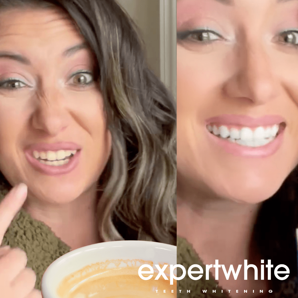 Expertwhite Teeth Whitening Gels 16%CP Teeth Whitening Gel (Gentle, Nite)