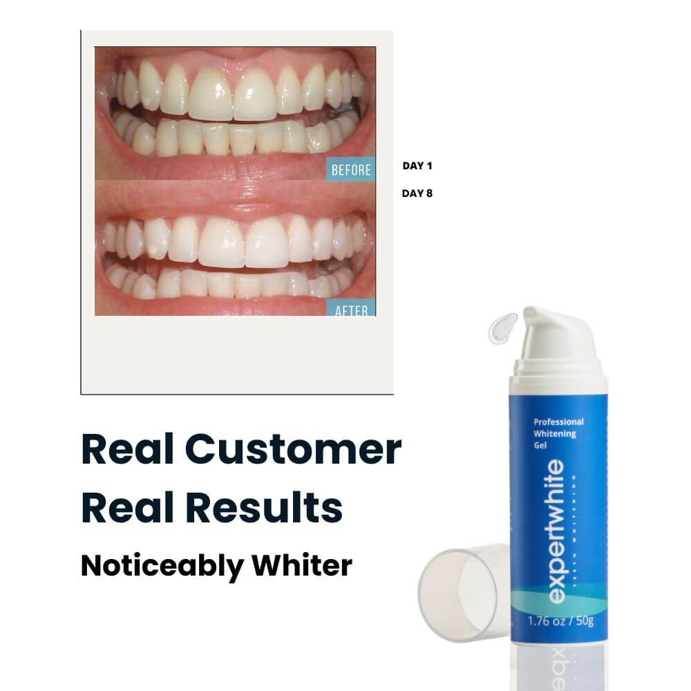 Expertwhite Teeth Whitening Gels Expertwhite WhiteBoost™