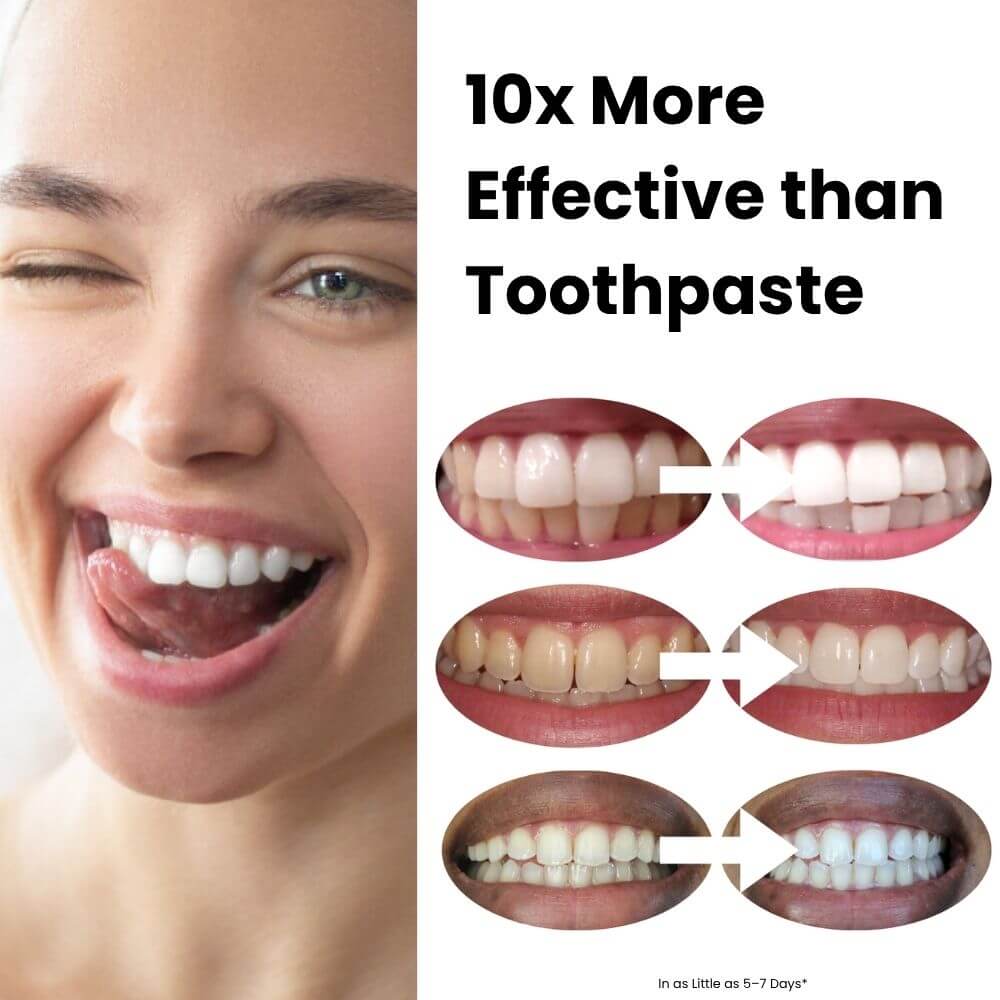 Expertwhite Teeth Whitening Gels Expertwhite WhiteBoost™ - Daily Whitening & Stain Remover