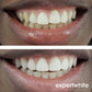 Expertwhite Teeth Whitening Gels Teeth Whitening Gel USA 22CP Pro+ (8 Gels) | Expertwhite