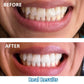 Expertwhite Teeth Whitening Kit Expertwhite LED Smile Radiance Teeth Whitening Kit