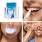 Expertwhite Teeth Whitening Kit LED Expertwhite Max LED Teeth Whitening Kit