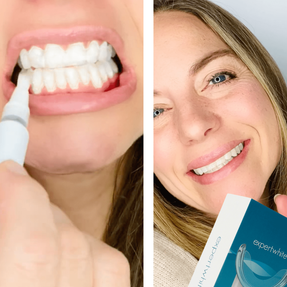 Expertwhite Teeth Whitening Kit LED One Kit Expertwhite LED Teeth Whitening Kit For Insane Results