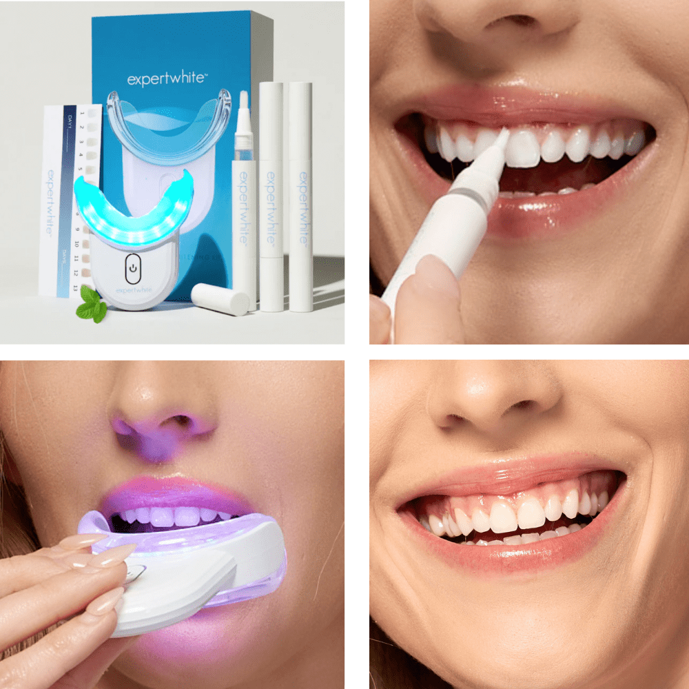 Expertwhite Teeth Whitening Kit LED One Kit The GleamUp LED Teeth Whitening Kit