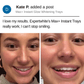 Expertwhite Teeth Whitening Kit LED Teeth Whitening Kit - Dentist Grade Advanced LED System