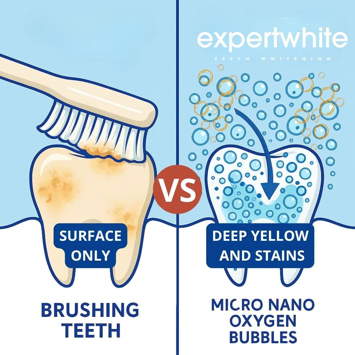 Expertwhite Teeth Whitening Kit LED Teeth Whitening Kit Max+ LED | Expertwhite