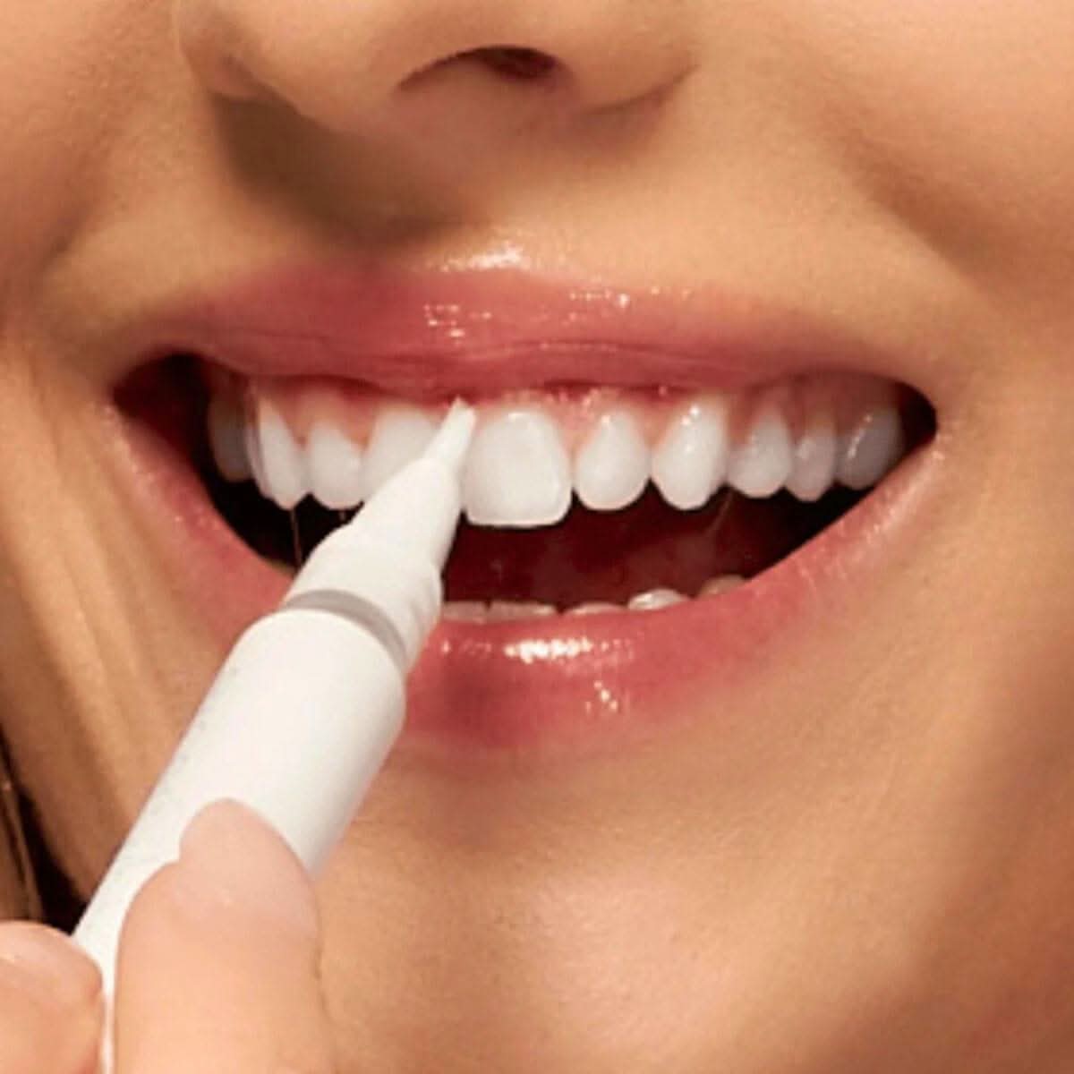 Teeth Whitening Kit - Advanced Dentist Grade Advanced LED System