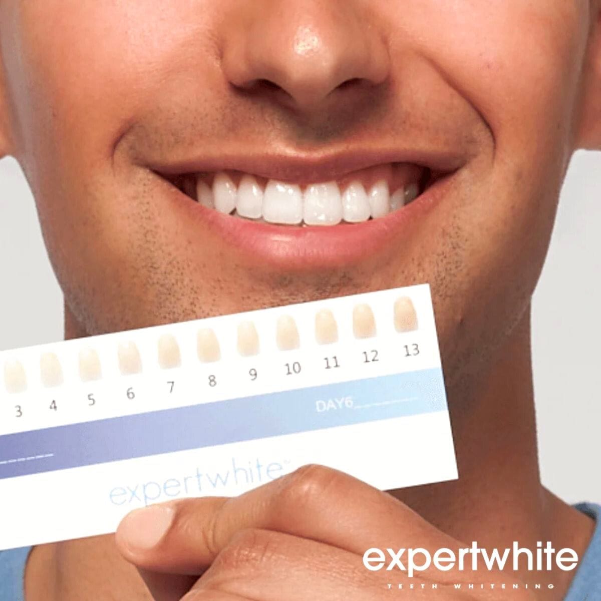 Expertwhite Teeth Whitening Kit Prefilled Teeth Whitening Trays 12HP – Max Strength Prefilled Whitening USA (3 Pack) – Expertwhite