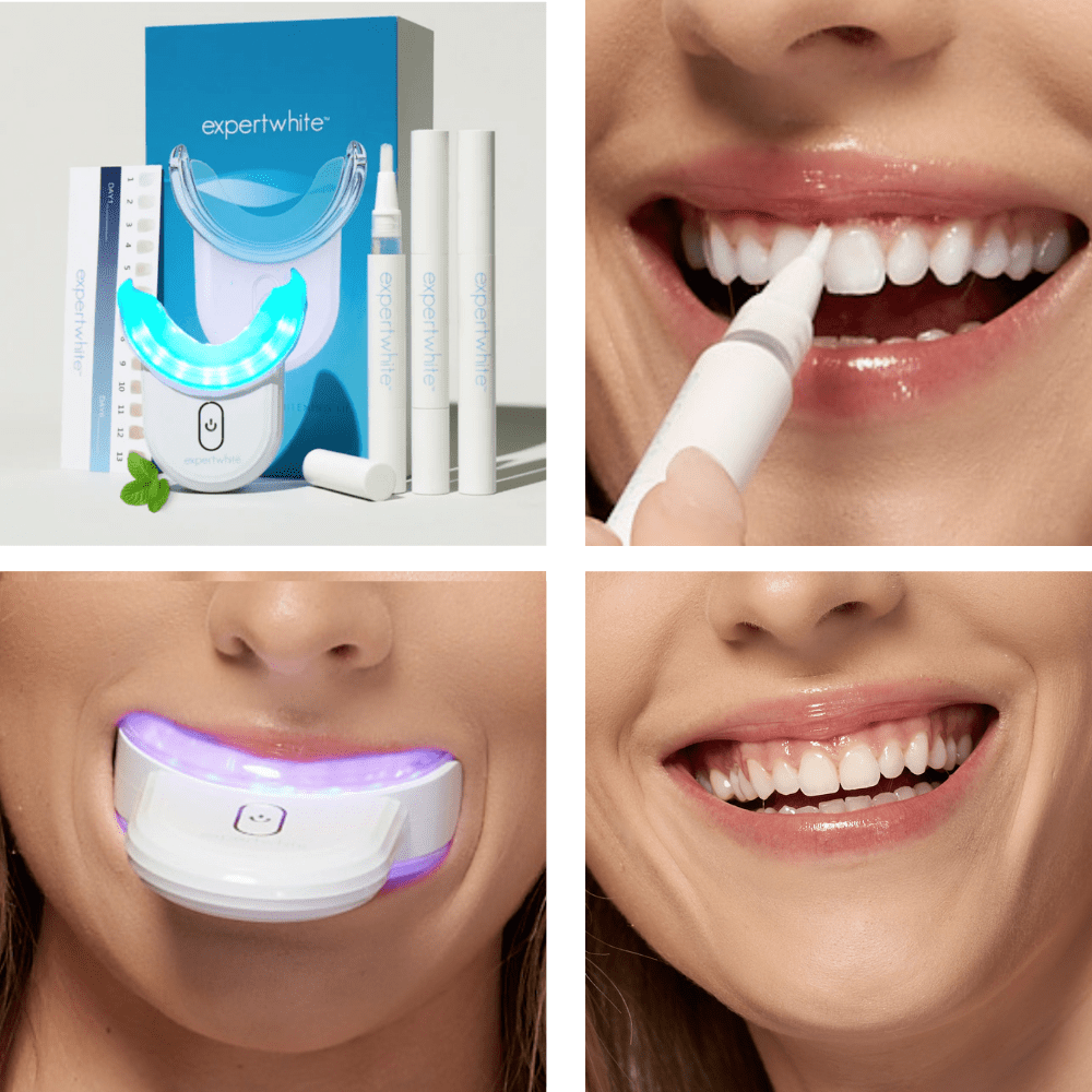 Expertwhite Teeth Whitening Kit WHITENING BUNDLE: The Expertwhite Insane Results Ultimate Teeth Whitening Bundle