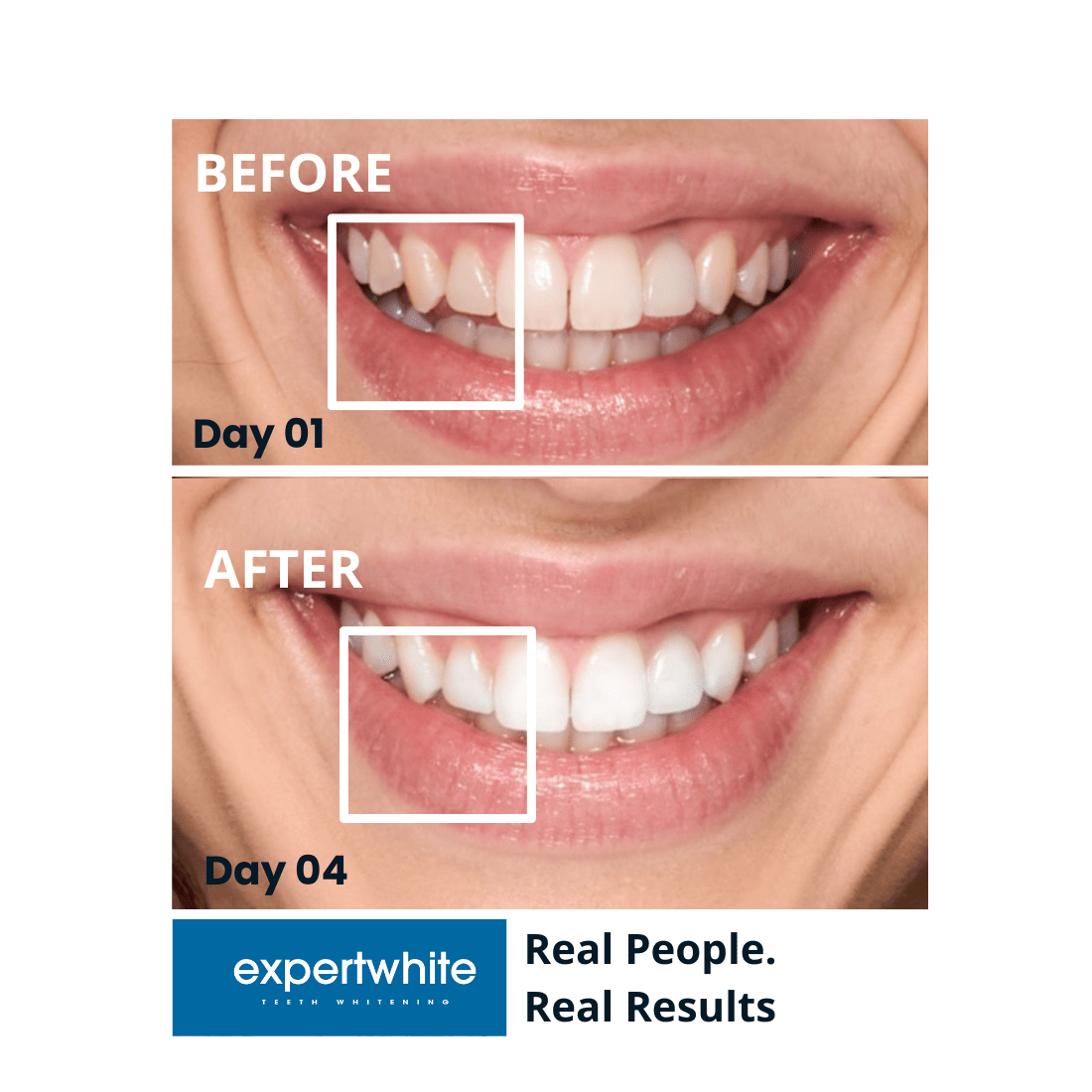 Expertwhite Teeth Whitening strips Expert White Strips - Instant Glow