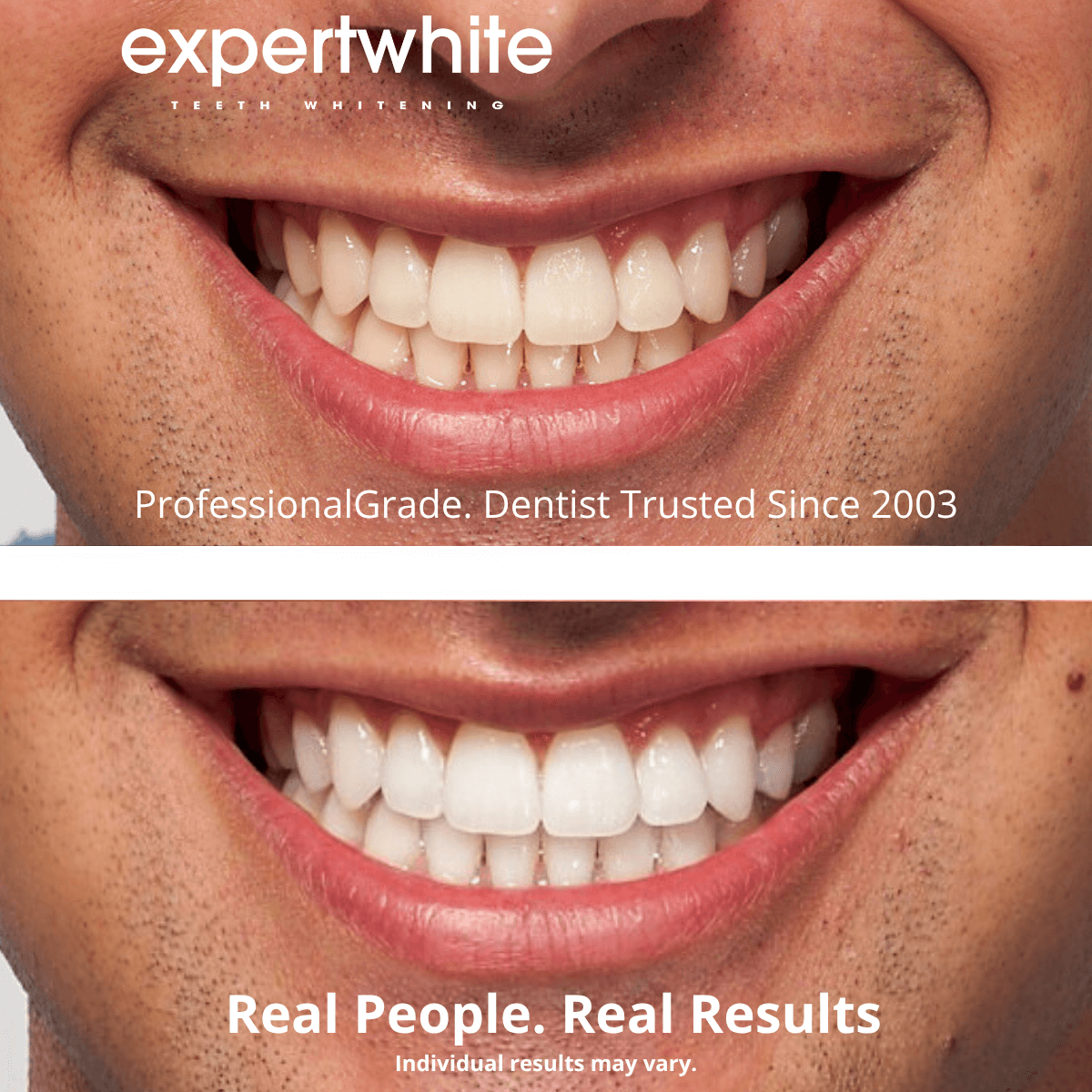 Expertwhite Teeth Whitening strips Expert White Strips - Instant Glow