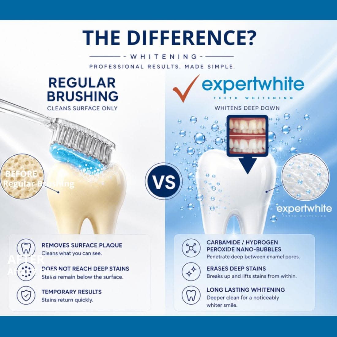 Expertwhite Teeth Whitening strips Expertwhite DryFit Teeth Whitening Strips