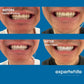 Expertwhite Teeth Whitening strips Expertwhite DryFit Teeth Whitening Strips