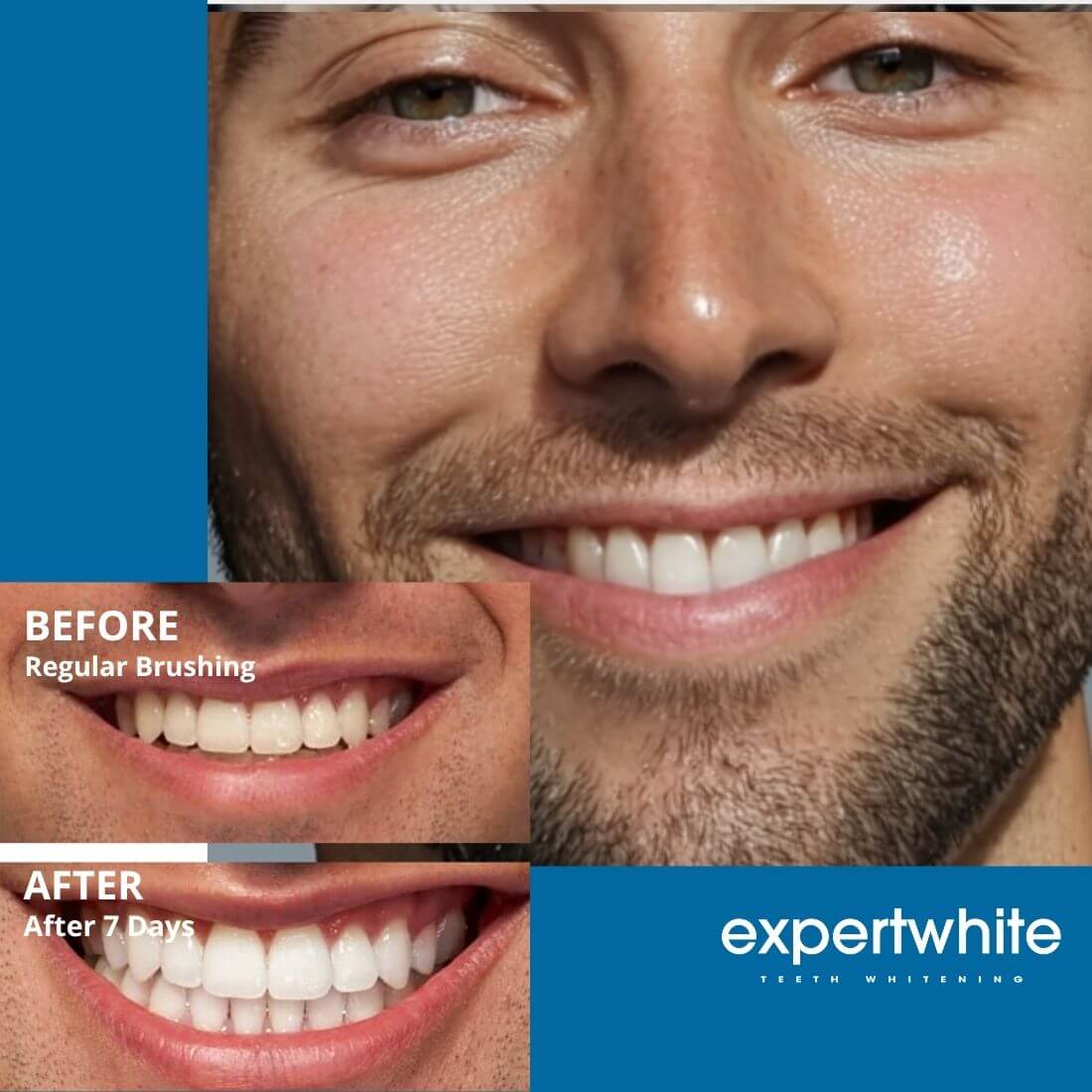 Expertwhite Teeth Whitening strips Expertwhite DryFit Teeth Whitening Strips