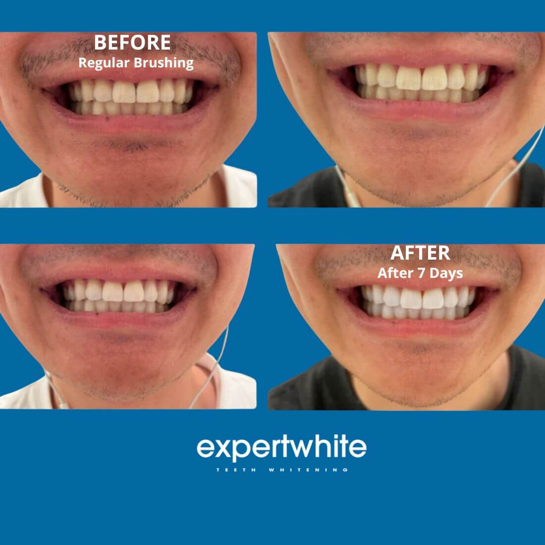 Expertwhite Teeth Whitening strips Expertwhite DryFit Teeth Whitening Strips