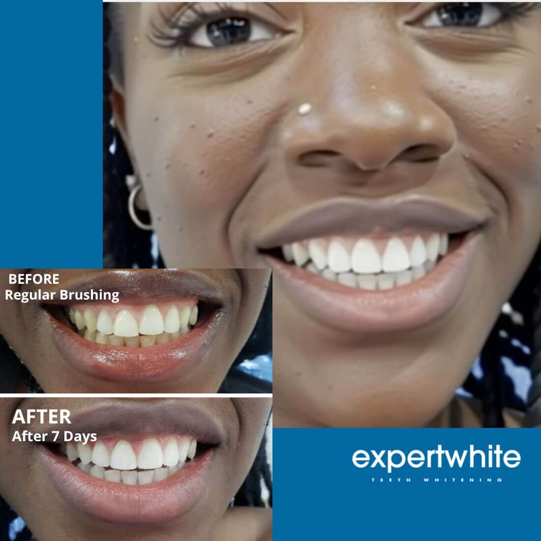 Expertwhite Teeth Whitening strips Expertwhite DryFit Teeth Whitening Strips