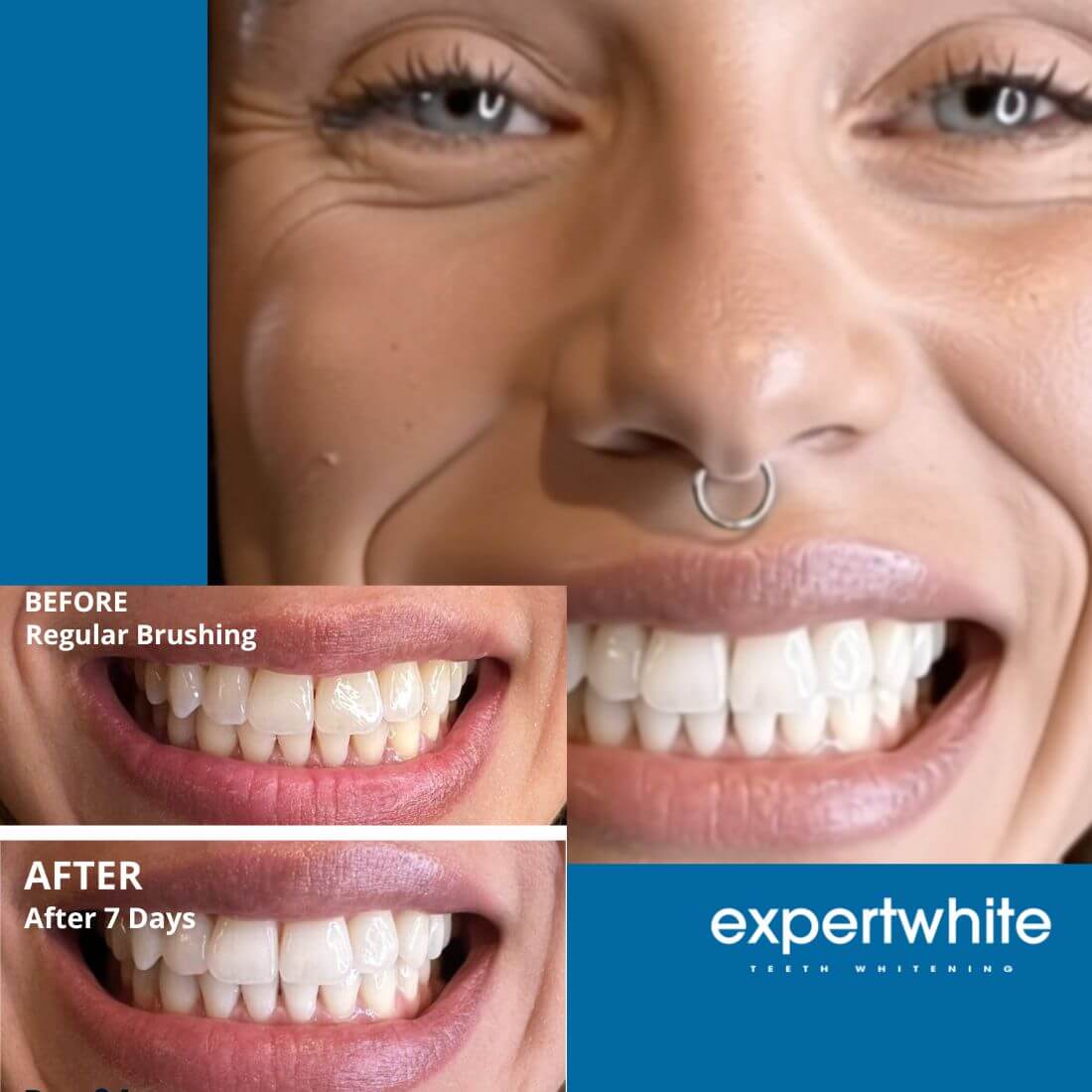 Expertwhite Teeth Whitening strips Expertwhite DryFit Teeth Whitening Strips