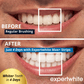 Expertwhite Teeth Whitening strips Expertwhite Max+ Instant Glow Whitening Strips