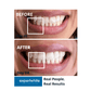 Expertwhite Teeth Whitening strips Expertwhite Max+ Teeth Whitening Strips