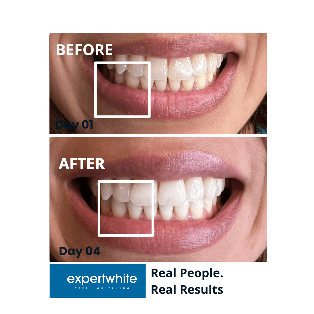 Expertwhite Teeth Whitening strips Expertwhite Max+ Teeth Whitening Strips
