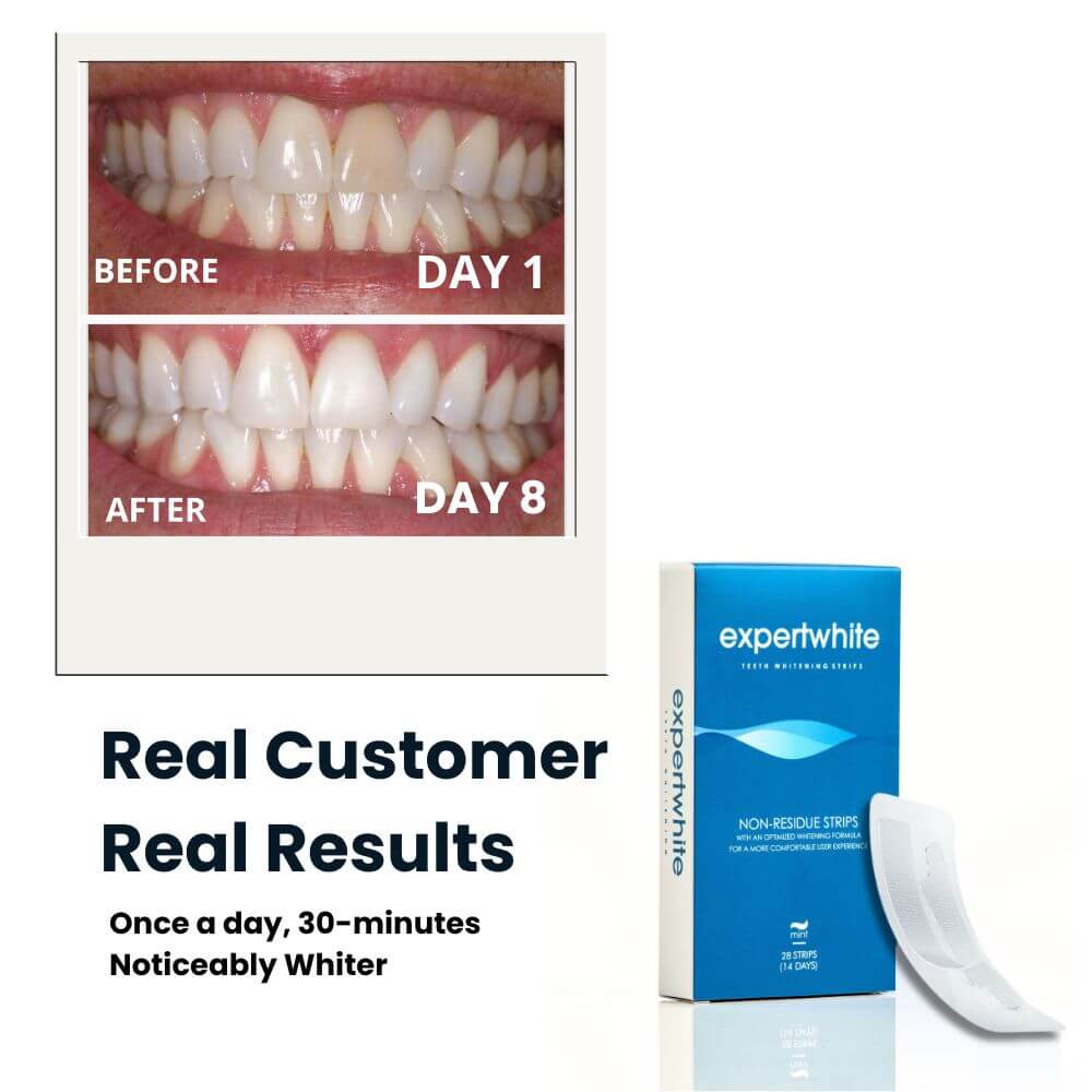 Shop All Teeth Whitening Products