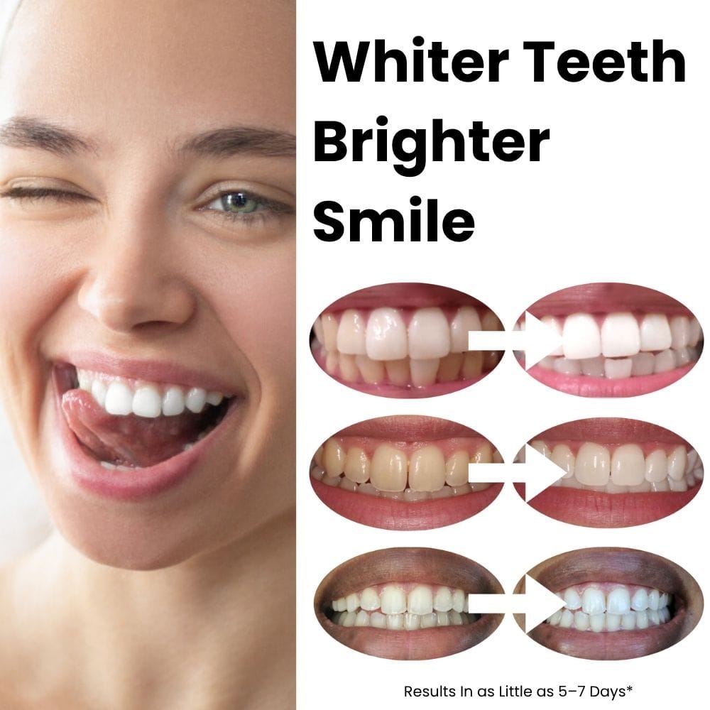 Expertwhite Teeth Whitening strips Expertwhite MaxStrips™