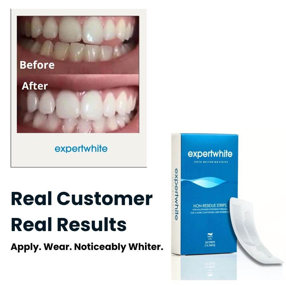 Expertwhite Teeth Whitening strips Expertwhite MaxStrips™ -     Professional Whitening Strips